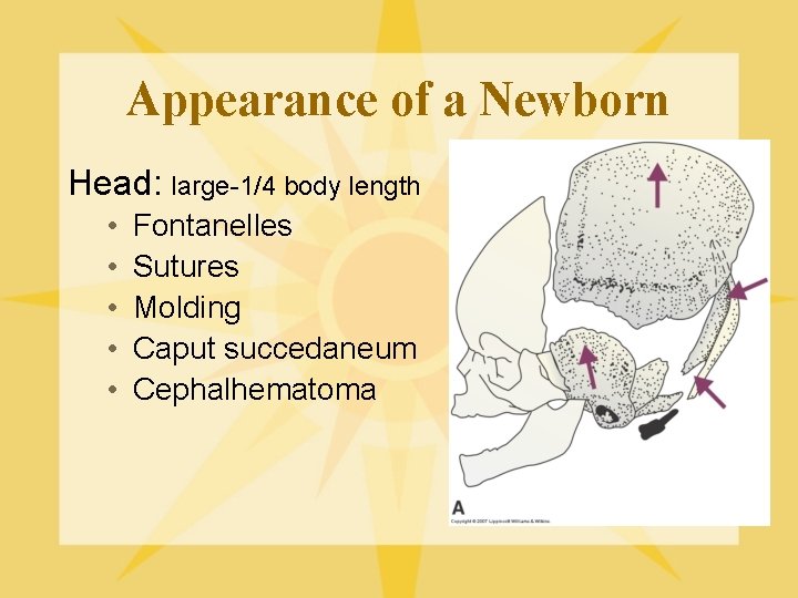 Appearance of a Newborn Head: large-1/4 body length • • • Fontanelles Sutures Molding