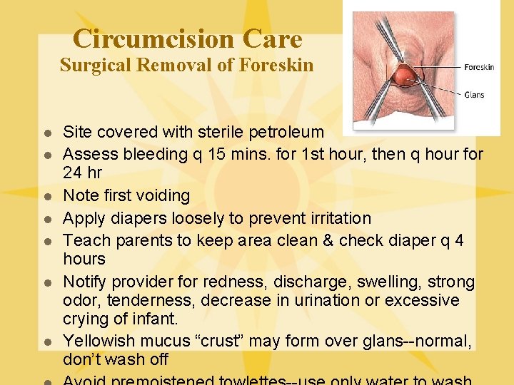 Circumcision Care Surgical Removal of Foreskin l l l l Site covered with sterile