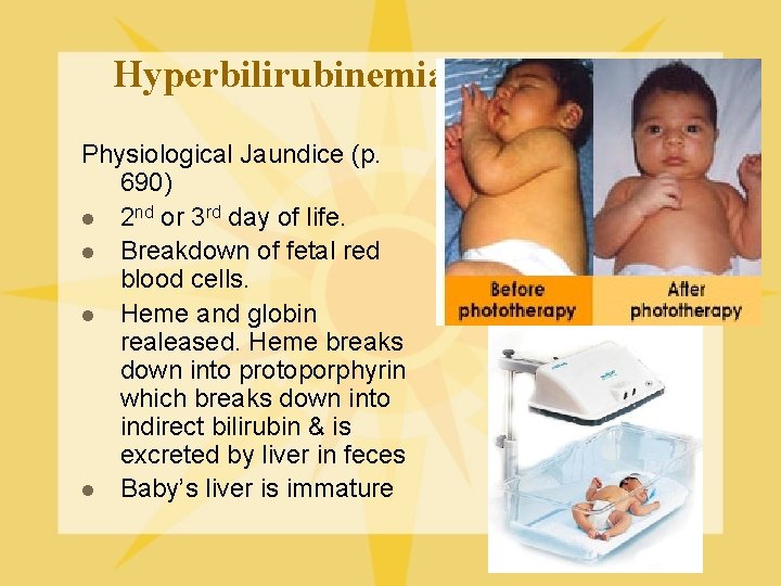 Hyperbilirubinemia Physiological Jaundice (p. 690) l 2 nd or 3 rd day of life.