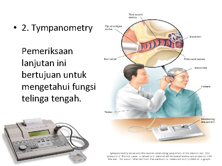  • 2. Tympanometry Pemeriksaan lanjutan ini bertujuan untuk mengetahui fungsi telinga tengah. 
