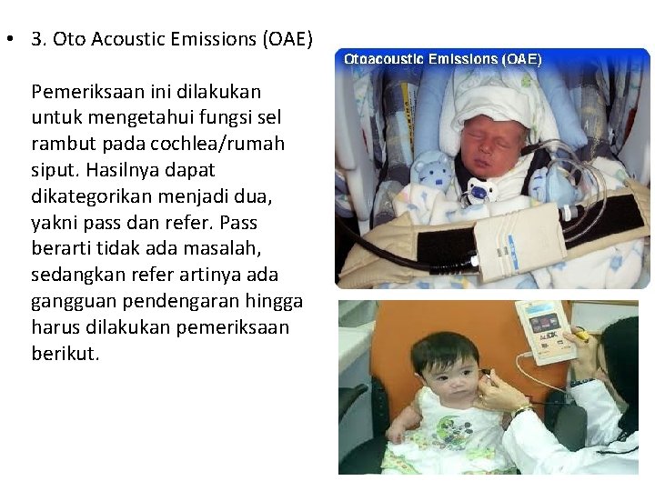  • 3. Oto Acoustic Emissions (OAE) Pemeriksaan ini dilakukan untuk mengetahui fungsi sel