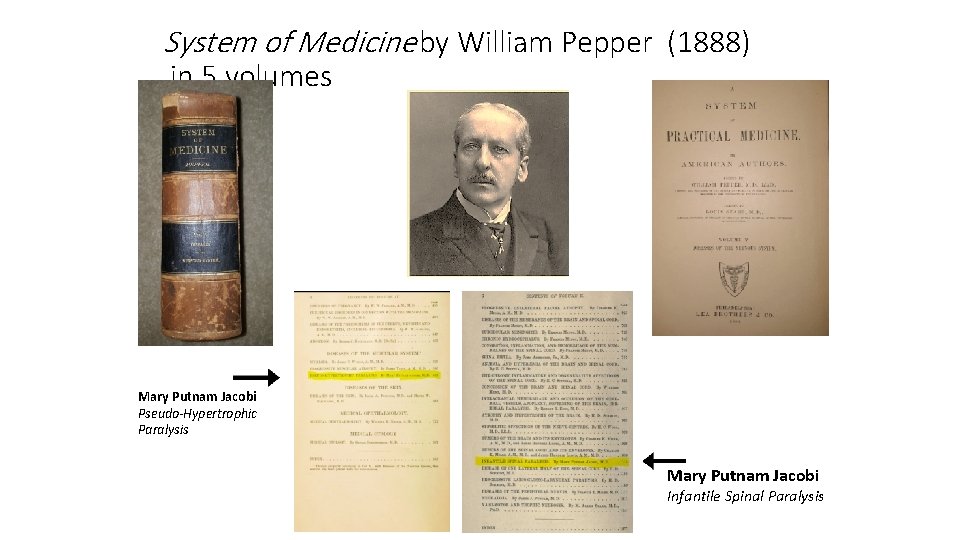 System of Medicine by William Pepper (1888) in 5 volumes • . Mary Putnam