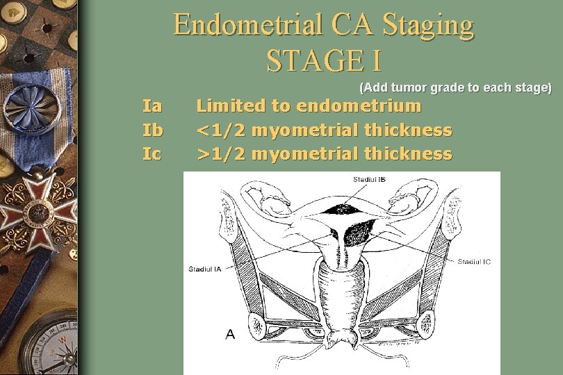 Endometrial CA Staging STAGE I (Add tumor grade to each stage) Ia Ib Ic