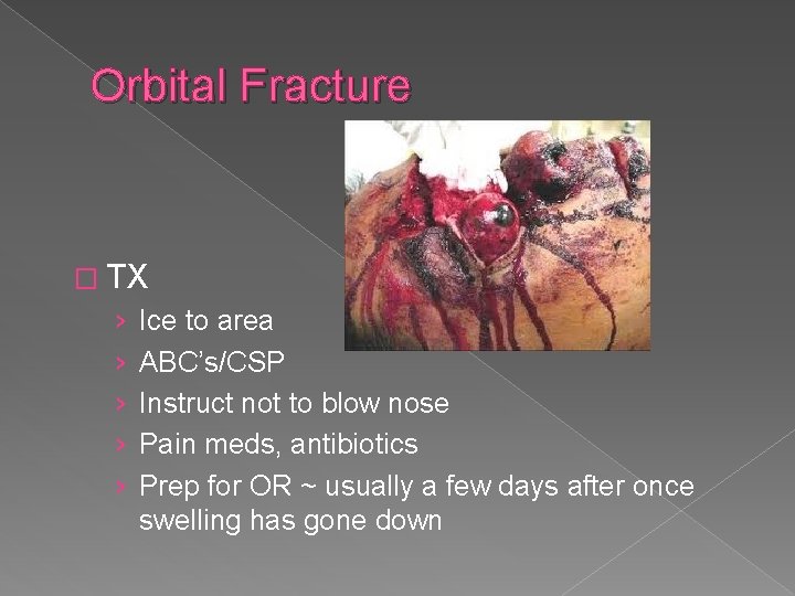 Orbital Fracture � TX › › › Ice to area ABC’s/CSP Instruct not to