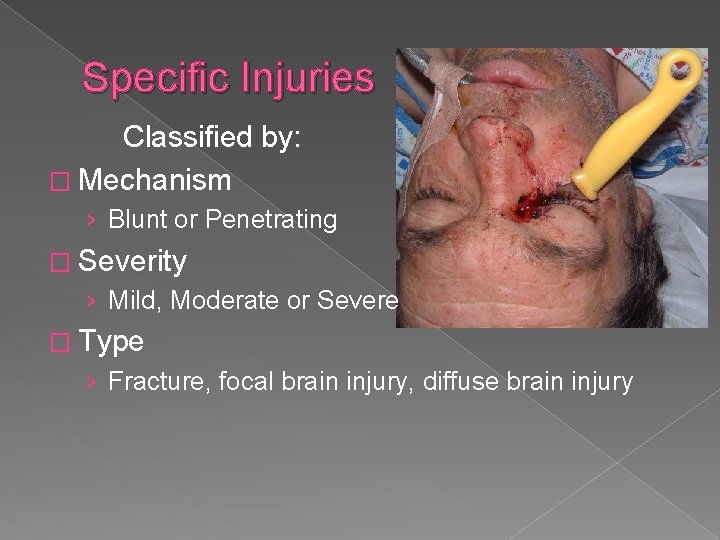 Specific Injuries Classified by: � Mechanism › Blunt or Penetrating � Severity › Mild,
