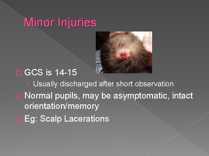 Minor Injuries � GCS is 14 -15 › Usually discharged after short observation �
