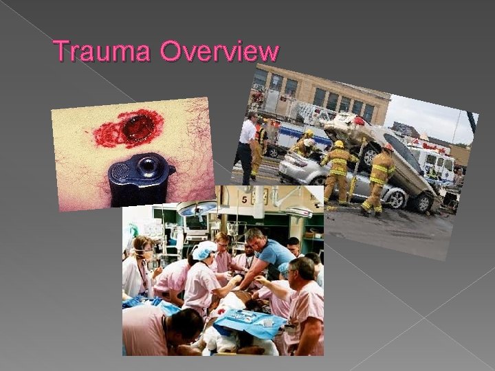 Trauma Overview 
