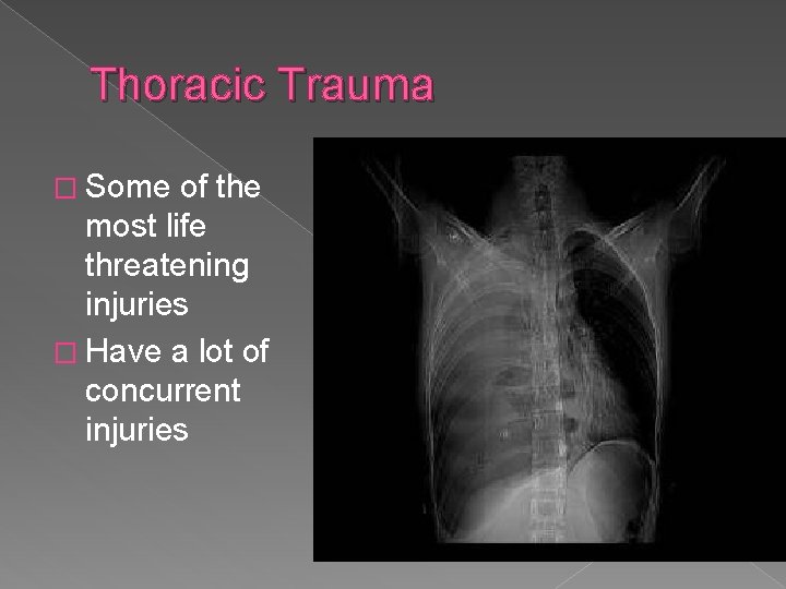 Thoracic Trauma � Some of the most life threatening injuries � Have a lot