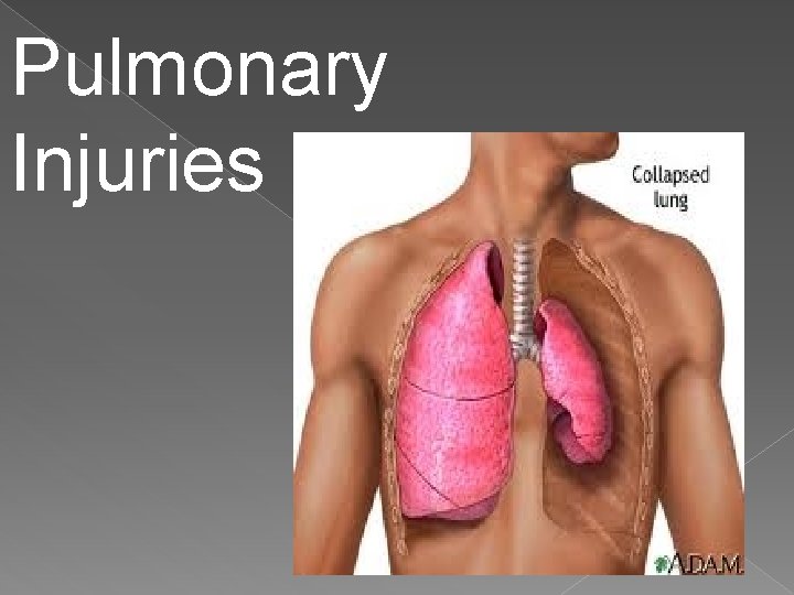 Pulmonary Injuries 