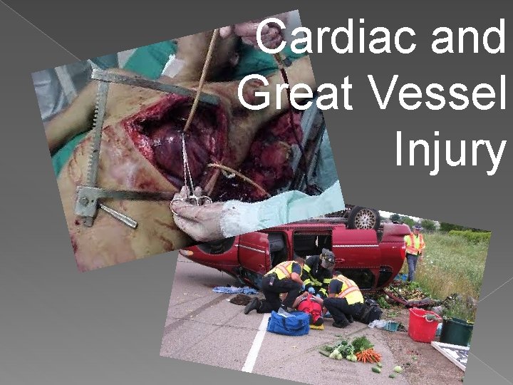 Cardiac and Great Vessel Injury 