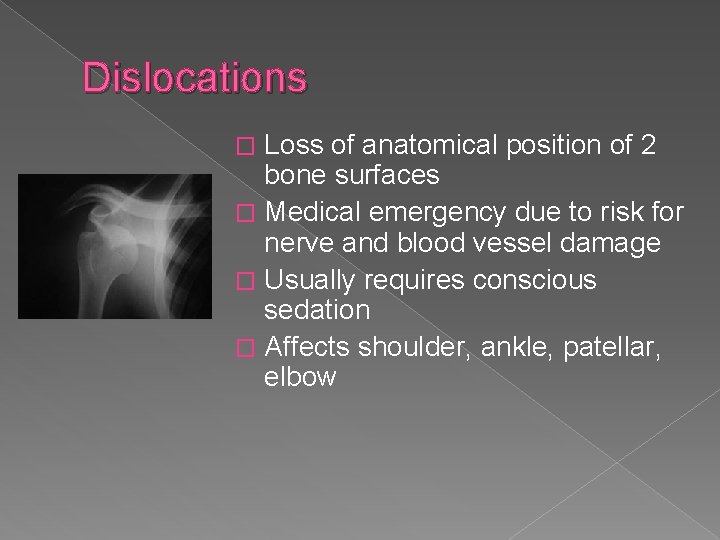 Dislocations Loss of anatomical position of 2 bone surfaces � Medical emergency due to