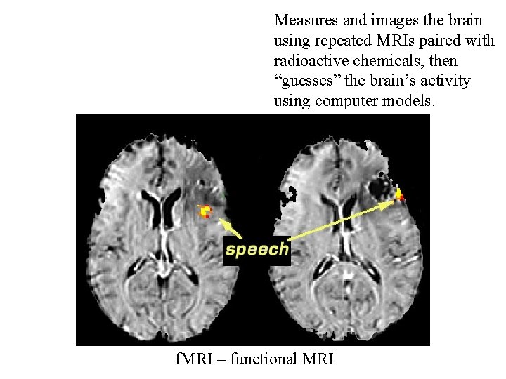 Measures and images the brain using repeated MRIs paired with radioactive chemicals, then “guesses”