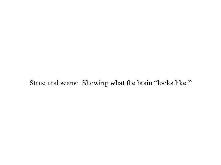 Structural scans: Showing what the brain “looks like. ” 