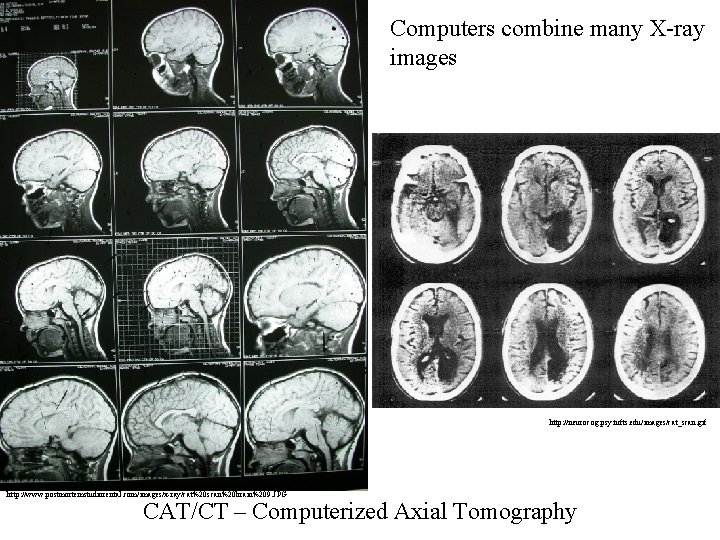 Computers combine many X-ray images http: //neurocog. psy. tufts. edu/images/cat_scan. gif http: //www. postmortemstudiorental.