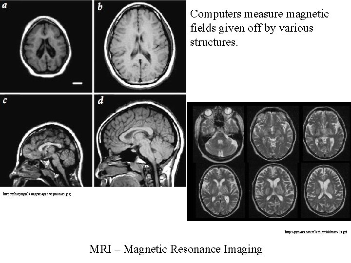 Computers measure magnetic fields given off by various structures. http: //pharyngula. org/images/aspm-mri. jpg http: