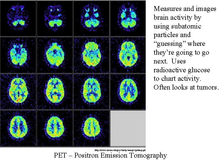 Measures and images brain activity by using subatomic particles and “guessing” where they’re going