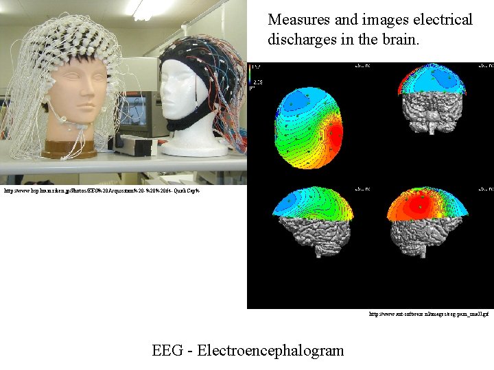 Measures and images electrical discharges in the brain. http: //www. bsp. brain. riken. jp/Photos/EEG%20