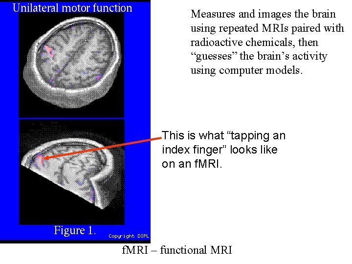 Measures and images the brain using repeated MRIs paired with radioactive chemicals, then “guesses”