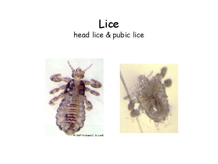 Lice head lice & pubic lice 