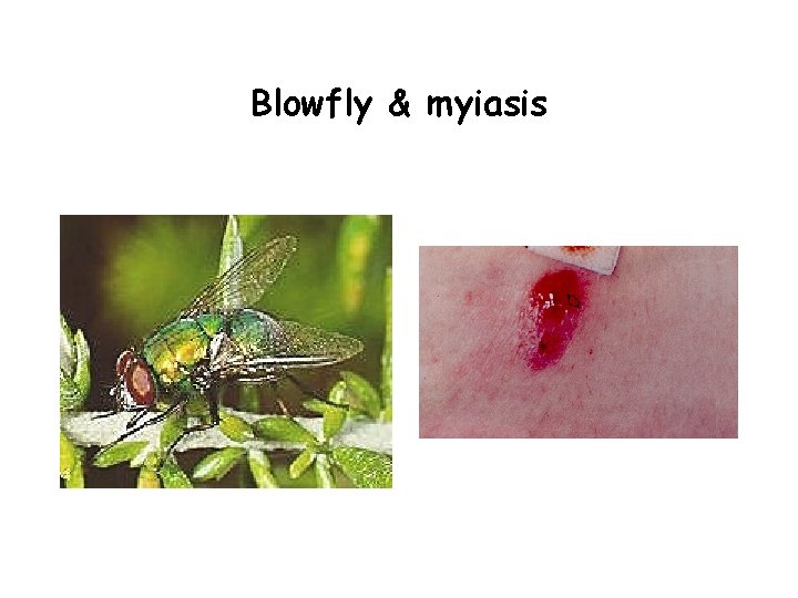 Blowfly & myiasis 