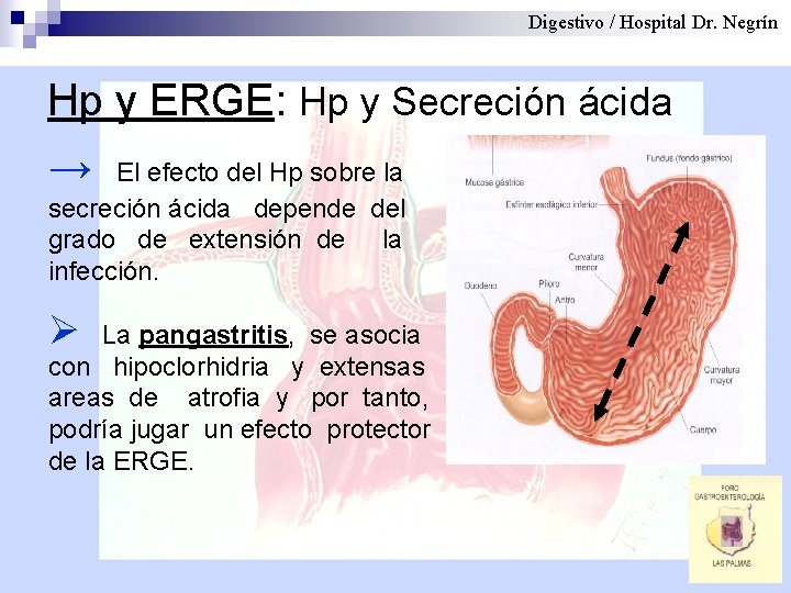 Digestivo / Hospital Dr. Negrín Hp y ERGE: Hp y Secreción ácida → El