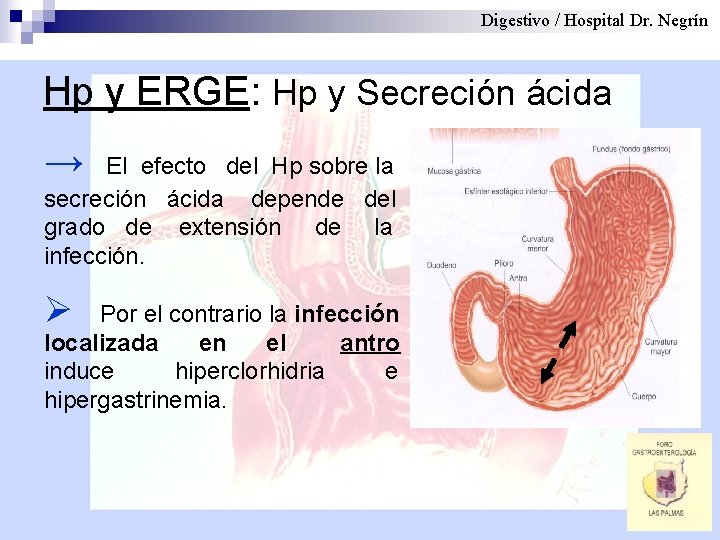 Digestivo / Hospital Dr. Negrín Hp y ERGE: Hp y Secreción ácida → El