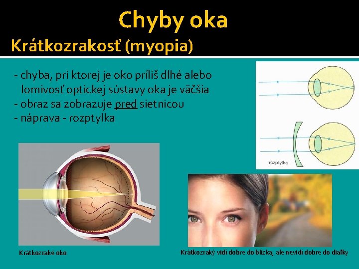 Chyby oka Krátkozrakosť (myopia) - chyba, pri ktorej je oko príliš dlhé alebo lomivosť