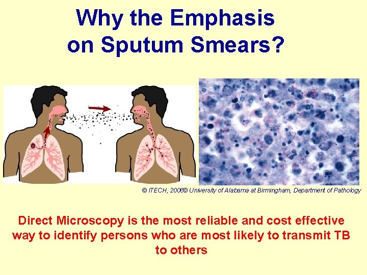 Why the Emphasis on Sputum Smears? © ITECH, 2006© University of Alabama at Birmingham,