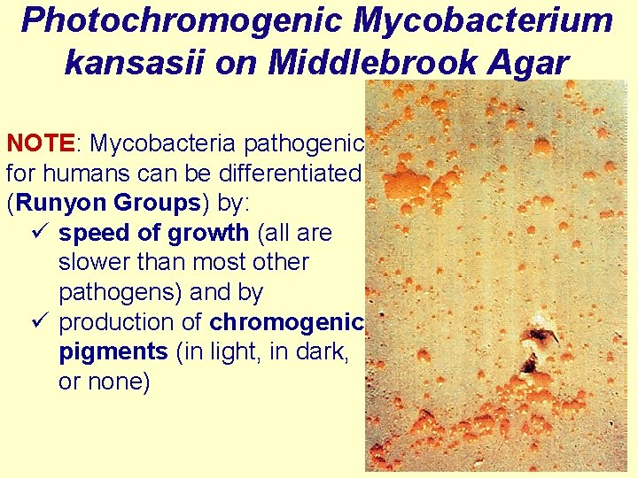Photochromogenic Mycobacterium kansasii on Middlebrook Agar NOTE: Mycobacteria pathogenic for humans can be differentiated