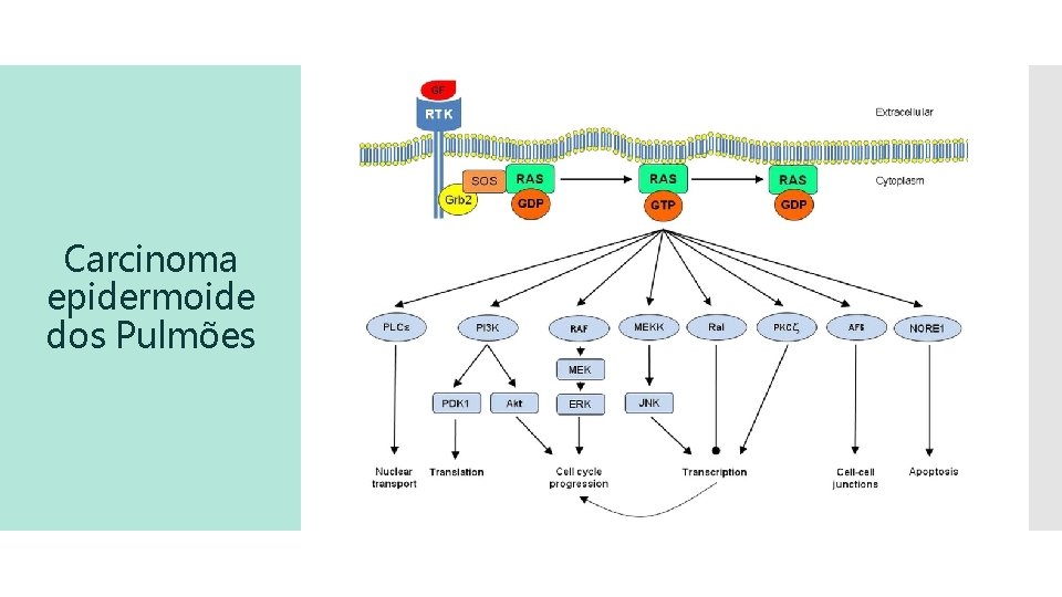 Carcinoma epidermoide dos Pulmões 