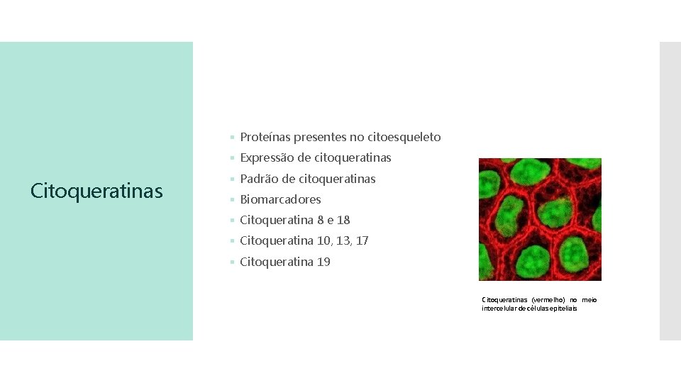 § Proteínas presentes no citoesqueleto § Expressão de citoqueratinas Citoqueratinas § Padrão de citoqueratinas