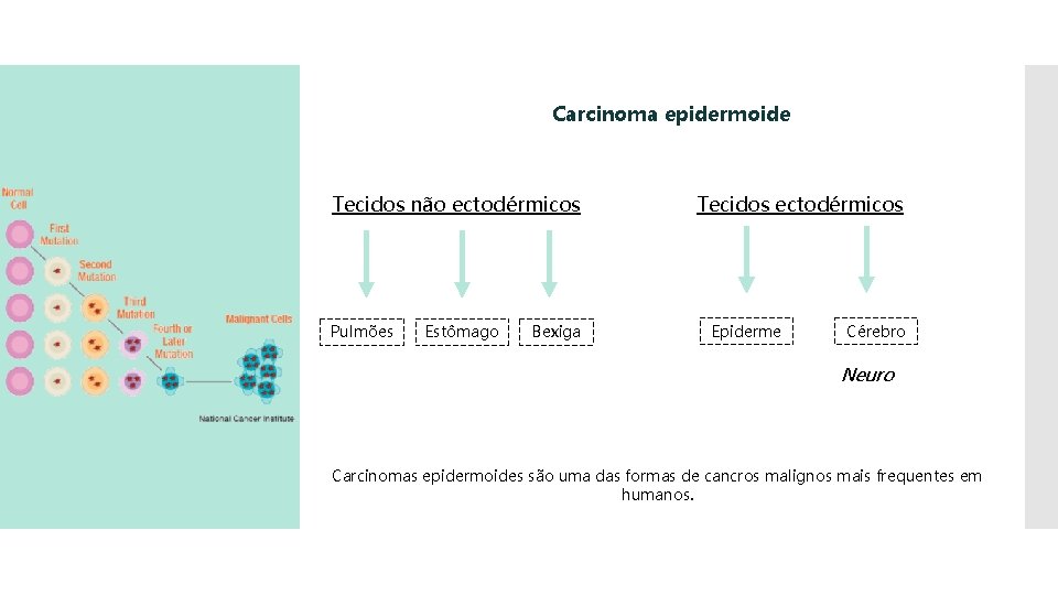 Carcinoma epidermoide Tecidos não ectodérmicos Pulmões Estômago Bexiga Tecidos ectodérmicos Epiderme Cérebro Neuro Carcinomas