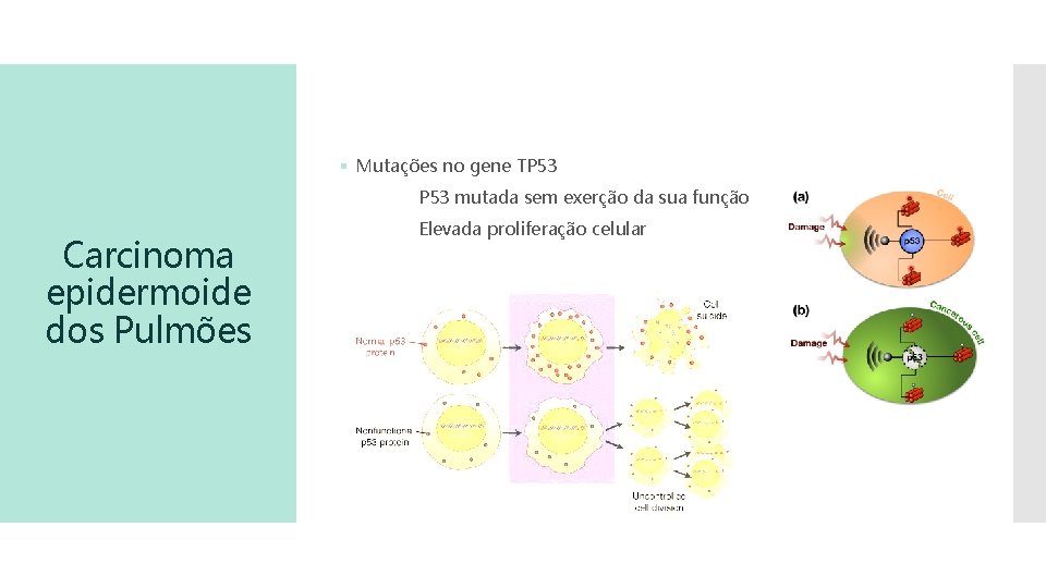 § Mutações no gene TP 53 mutada sem exerção da sua função Carcinoma epidermoide