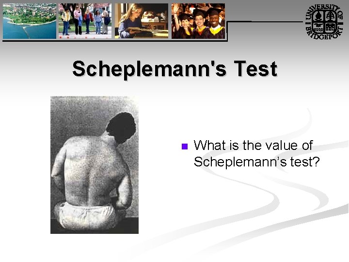 Scheplemann's Test n What is the value of Scheplemann’s test? 