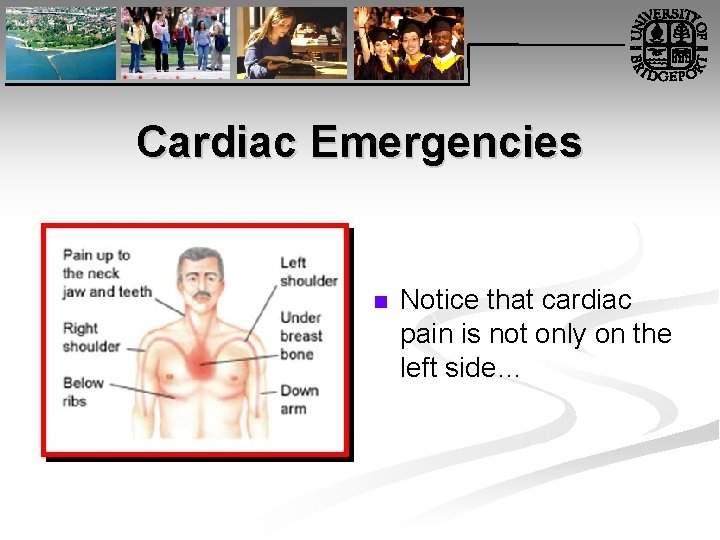 Cardiac Emergencies n Notice that cardiac pain is not only on the left side…
