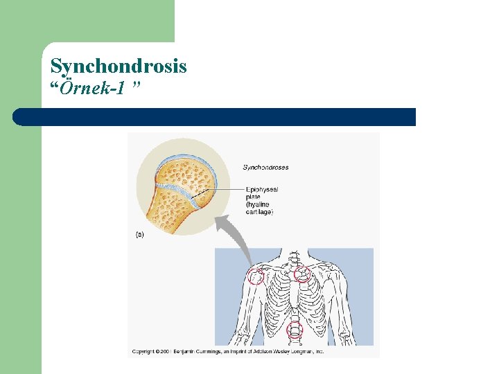 Synchondrosis “Örnek-1 ” 
