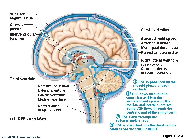 Superior sagittal sinus 4 Choroid plexus Arachnoid villus Interventricular foramen Subarachnoid space Arachnoid mater