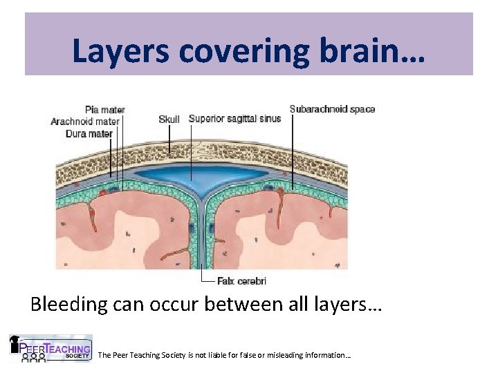 Layers covering brain… Bleeding can occur between all layers… The Peer Teaching Society is