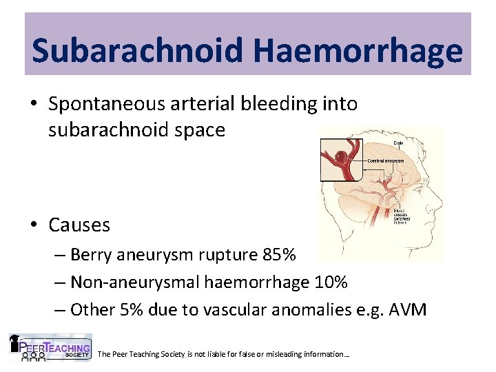 Subarachnoid Haemorrhage • Spontaneous arterial bleeding into subarachnoid space • Causes – Berry aneurysm