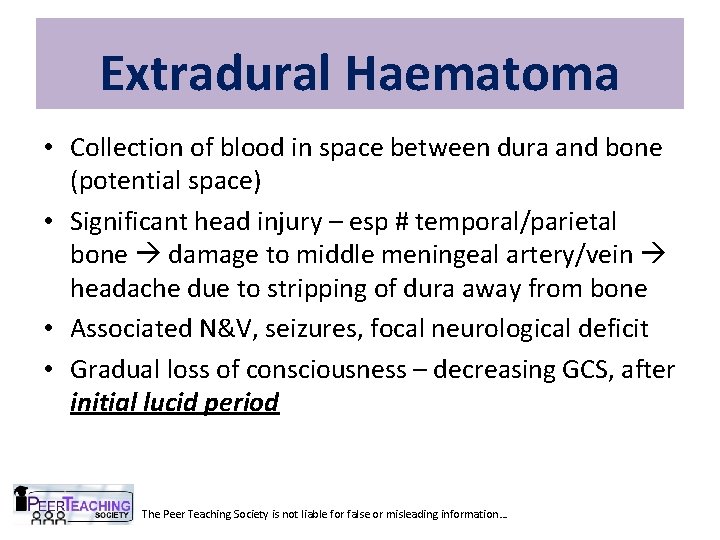 Extradural Haematoma • Collection of blood in space between dura and bone (potential space)