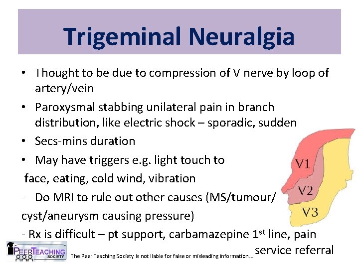 Trigeminal Neuralgia • Thought to be due to compression of V nerve by loop