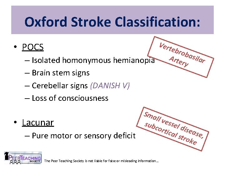 Oxford Stroke Classification: Vert ebro bas ilar Arte – Isolated homonymous hemianopia ry •