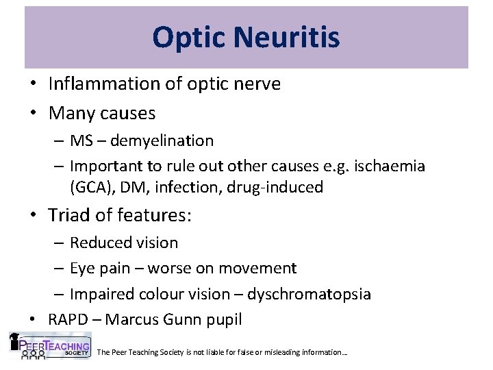 Optic Neuritis • Inflammation of optic nerve • Many causes – MS – demyelination