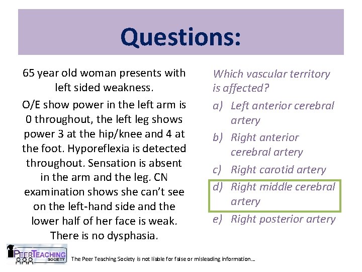 Questions: 65 year old woman presents with left sided weakness. O/E show power in