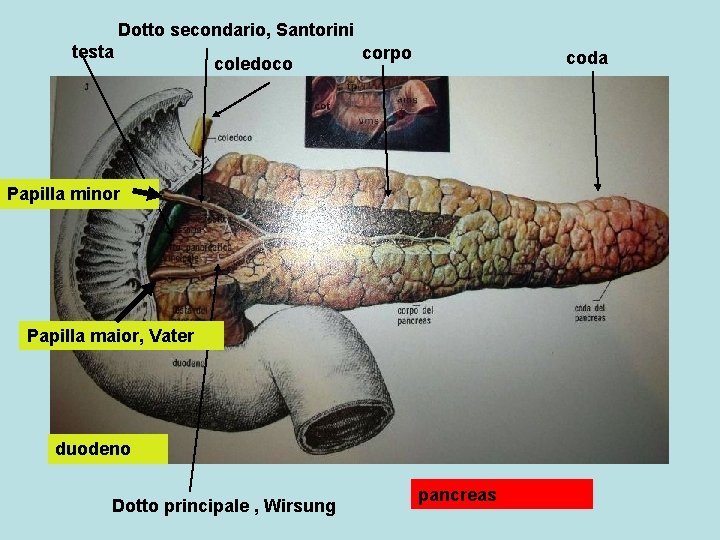 Dotto secondario, Santorini testa coledoco corpo coda Papilla minor Papilla maior, Vater duodeno Dotto