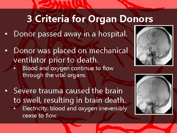 3 Criteria for Organ Donors • Donor passed away in a hospital. • Donor