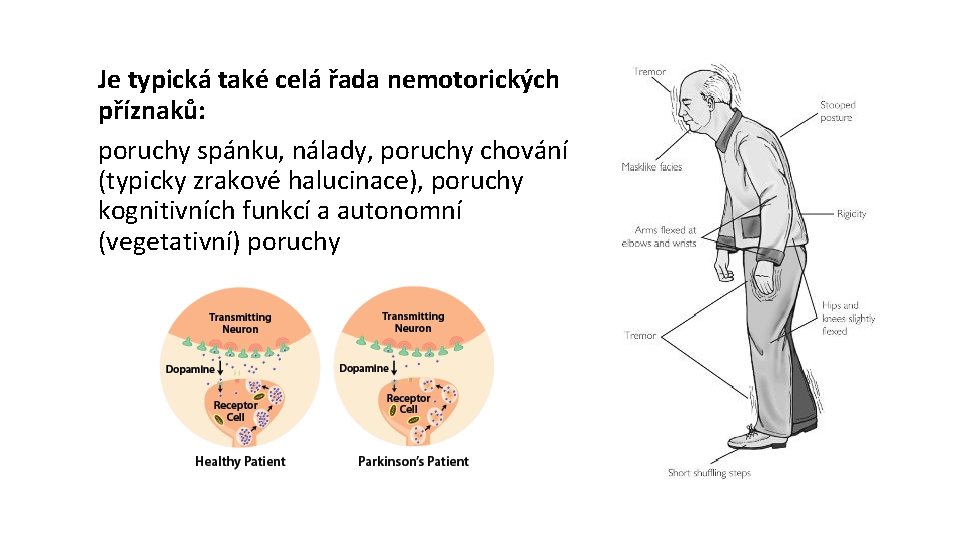 Je typická také celá řada nemotorických příznaků: poruchy spánku, nálady, poruchy chování (typicky zrakové