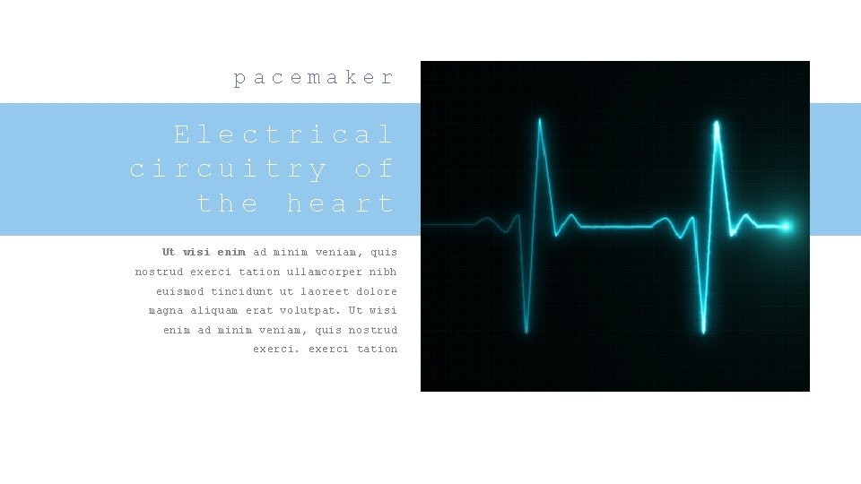 pacemaker Electrical circuitry of the heart Ut wisi enim ad minim veniam, quis nostrud