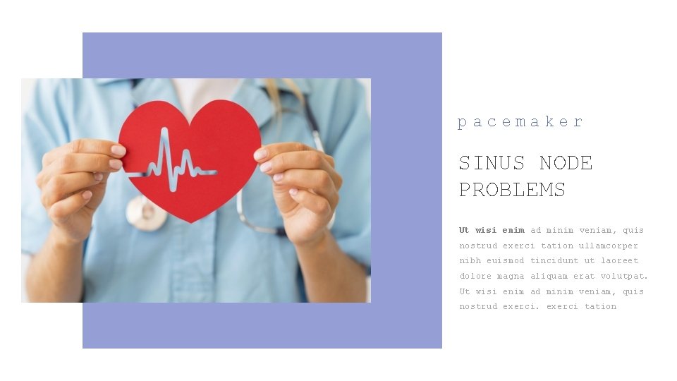 pacemaker SINUS NODE PROBLEMS Ut wisi enim ad minim veniam, quis nostrud exerci tation