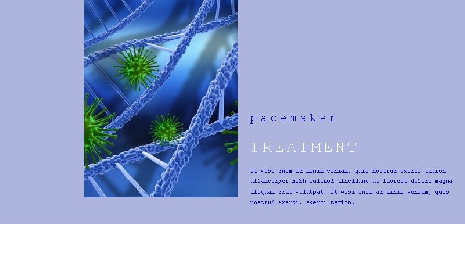 pacemaker TREATMENT Ut wisi enim ad minim veniam, quis nostrud exerci tation ullamcorper nibh